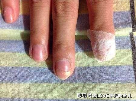 只需审视手势！肝脏健康的秘诀就在此四个迹象作为测量准则(图2)