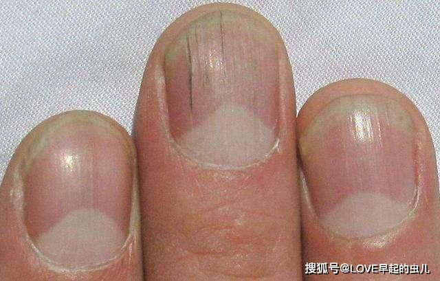 只需审视手势！肝脏健康的秘诀就在此四个迹象作为测量准则(图3)
