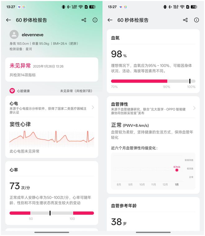 OPPOWatchX2评测：更完善的健康检测体验新一代安卓表皇(图12)