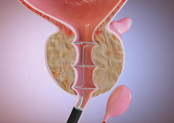 最新出炉！2024年全球医疗科技新锐奖(图19)