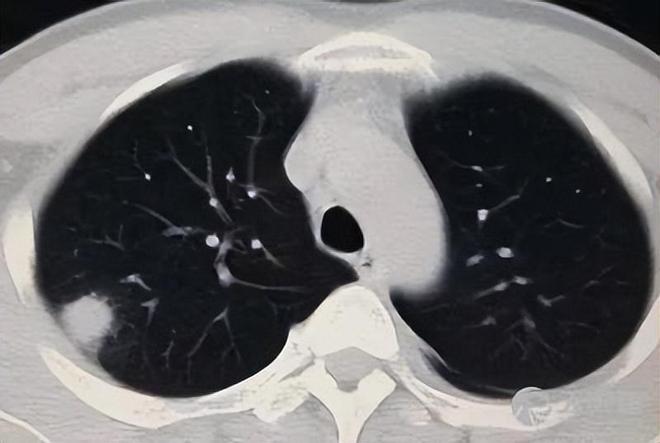 北京发布百万体检大数据深层次抛开人群健康状况你要小心了(图4)