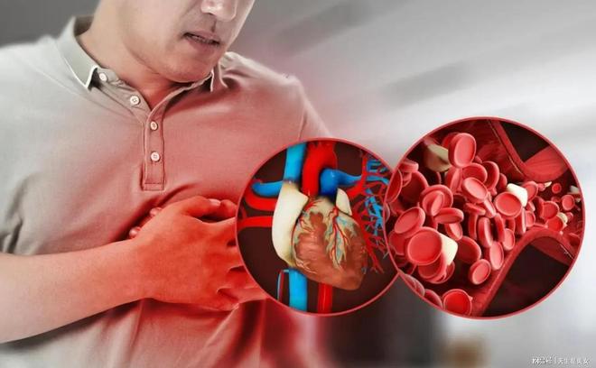 专家提醒：避开三大健康杀手早筛可延寿20年(图2)